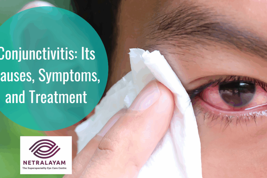 Conjunctivitis Its Causes Symptoms And Treatment
