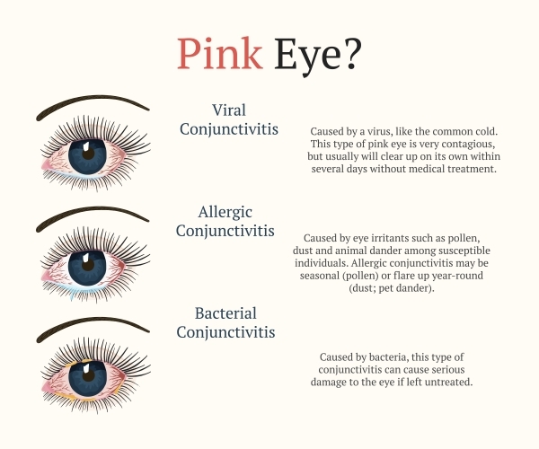Pink Eye Conjunctivitis Treatment And Diagnosis 60 OFF