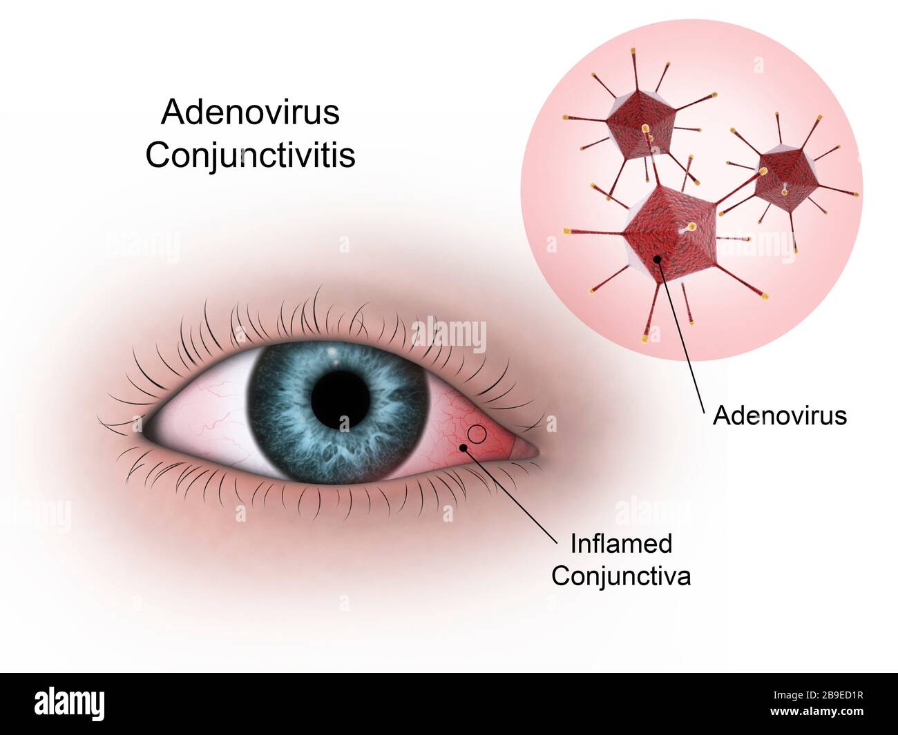 conjunctive eye